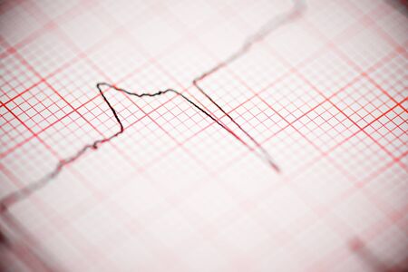 Close up of an electrocardiogram in paper form.