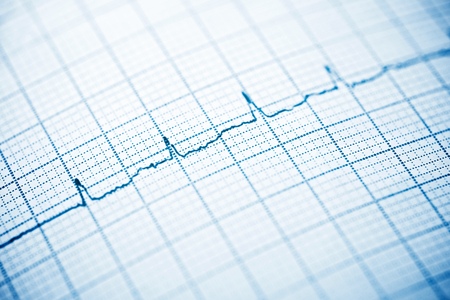 Close up of an electrocardiogram in paper form.の写真素材