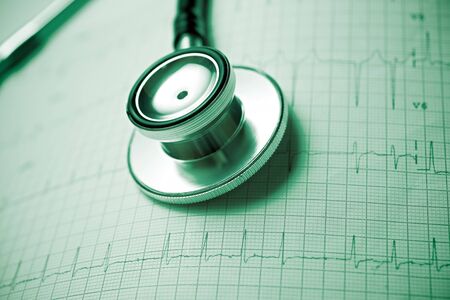 Close up of an electrocardiogram in paper form and a stethoscope.の写真素材