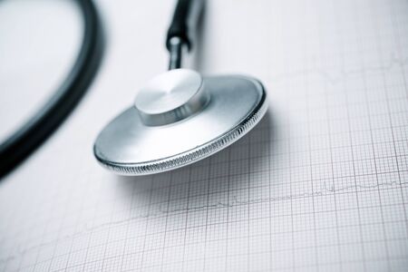 Close up of an electrocardiogram in paper form and a stethoscope.