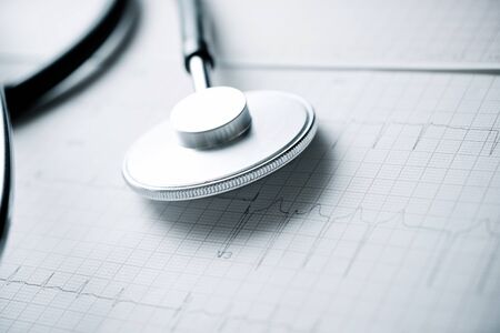 Close up of an electrocardiogram in paper form and a stethoscope.の写真素材