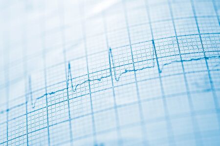 Close up of an electrocardiogram in paper form.の写真素材