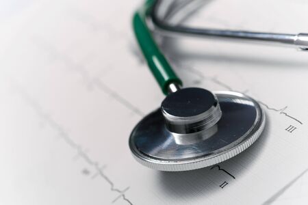Close up of an electrocardiogram in paper form and a stethoscope.の写真素材