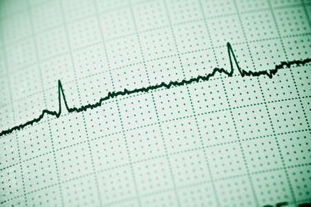 Close up of an electrocardiogram in paper form.の写真素材