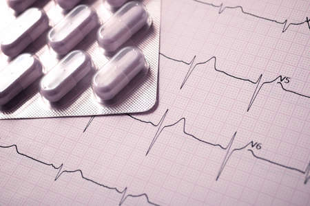 Forefront of a medicine pills in blister pack and electrocardiogram.の写真素材