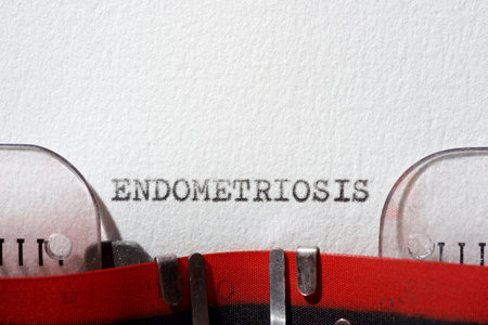 Endometriosis word written with a typewriter.の写真素材