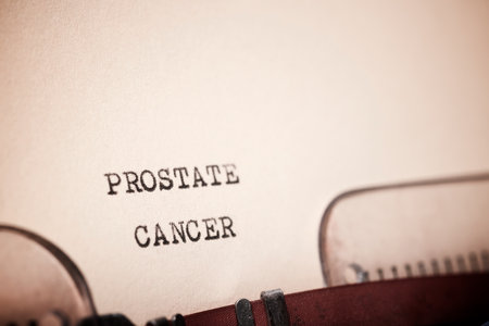 Prostate cancer text written with a typewriter.の写真素材