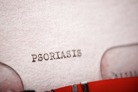 Psoriasis word written with a typewriter.の写真素材