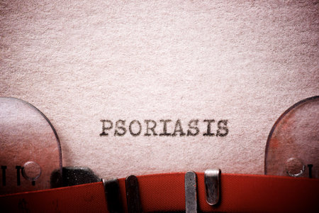 Psoriasis word written with a typewriter.の写真素材