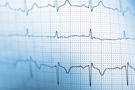 Electrocardiogram showing the pulse of the human heartの写真素材