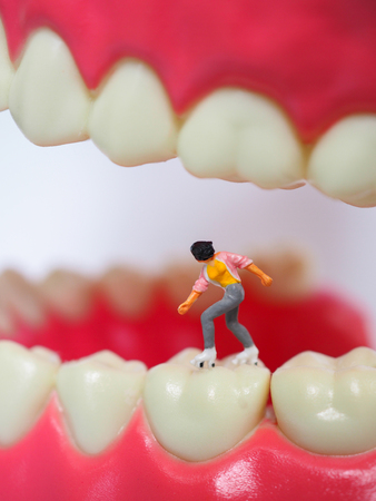 Miniature teenager girl skating on plastic teeth of removable denture. Dental health concept.
