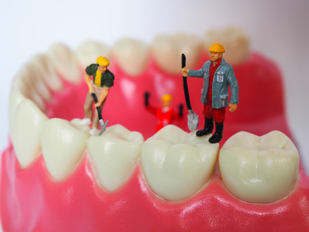 Miniature worker on plastic teeth of removable denture. Dental health conceptの写真素材