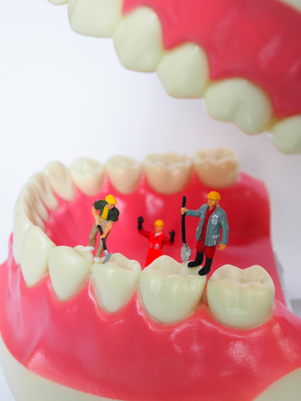Miniature worker on plastic teeth of removable denture. Dental health conceptの写真素材