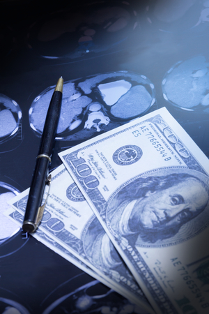 Pen and money on CT-scan flim.の写真素材