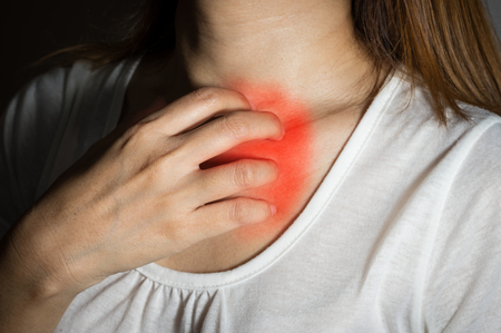 Woman scratching neck skin.の写真素材