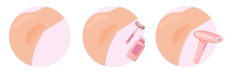 Epilation and depilation armpits different methods.のイラスト素材