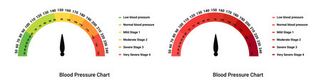 Blood pressure scale chart. Stage test with arrow and diagram indicators of hypo and hypertension with graphic infographics of cardio vector measurementのイラスト素材