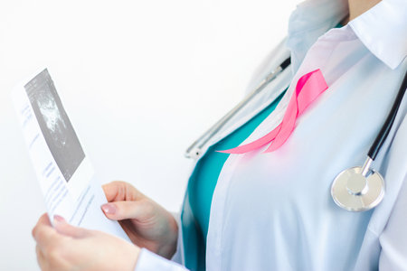 Woman doctor with pink ribbon on white medical uniform holds results of ultrasound scan in her hands. Breast cancer awareness month symbol. Health care concept. Copy space, selective focusの写真素材