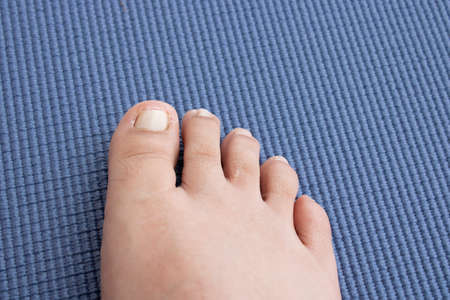 Skin problems that a dermatologist or skin specialist should attend toの写真素材