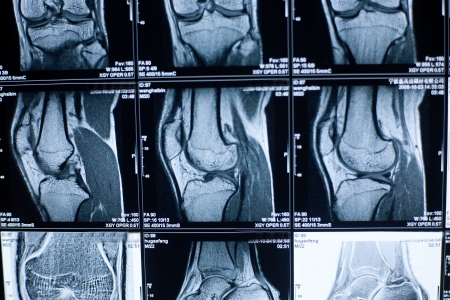 X-ray photograph of human organsの写真素材