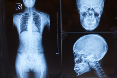 Human body X-ray photosの写真素材