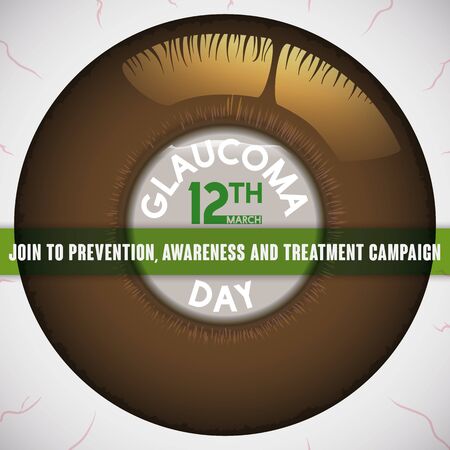 Poster for World Glaucoma Day with brown iris and cloudy cornea due accumulated liquid, promoting awareness, prevention and treatment campaign against glaucoma.のイラスト素材