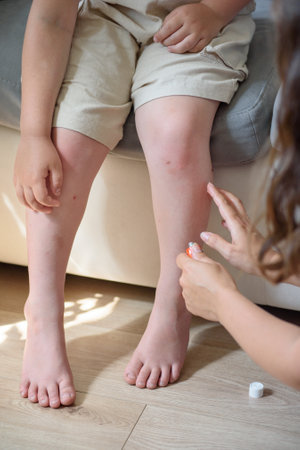 mother smears her child with ointment for mosquito bites. verticalの写真素材