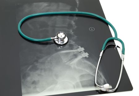 Stethoscope on a set of medical Xrays allow the doctor to view the bones underneath the skin 