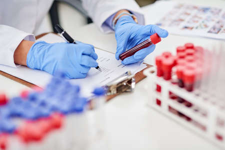 Compiling a detailed report of the latest findings. Closeup shot of a scientist examining a blood...