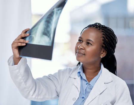 Shes noticed something.... Shot of a young doctor analysing an x-ray in a hospital.