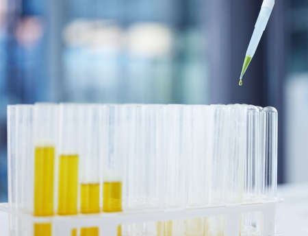 Each experiment serves a purpose. Shot of liquid being poured into tubes in a laboratory.