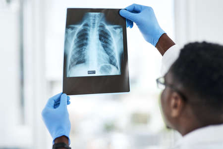 The answer is hidden between the lines. Shot of a young doctor analysing an x ray of a patients...