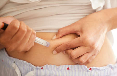 Getting her insulin levels back to normal. Closeup shot of an unrecognizable woman injecting herself in the stomach with insulin at home.の写真素材