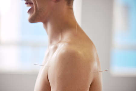 I feel so relieved. a man enjoying an acupuncture treatment.の写真素材