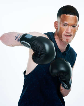Boxing is my therapy. Portrait shot of a handsome young male boxer with vitiligo posing in studio.