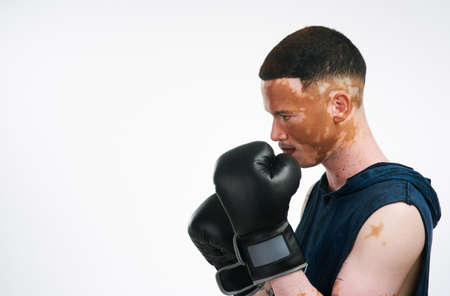 Sometimes the best way to throw a punch is to take one step back. Portrait shot of a handsome young male boxer with vitiligo posing in studio.の写真素材