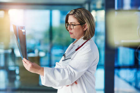 Shes focused on finding a suitable treatment procedure. a doctor analyzing an x-ray in a hospital.の写真素材