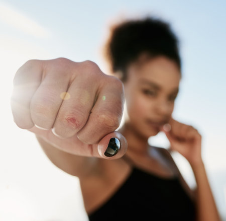 Your pain today will be your strength tomorrow. Closeup shot of a sporty young woman with a scar on her hand.の写真素材
