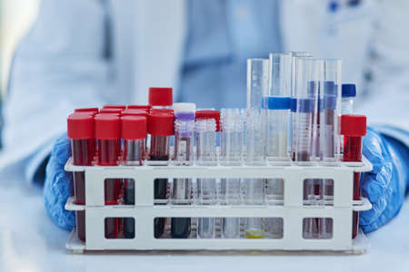 Tubes for testing. Closeup shot of various test tubes lined in a tray in a lab.