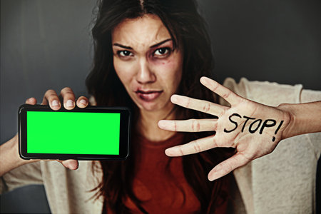 Reach out for help. Portrait of a bruised young woman holding a cellphone and the word STOP on her hand.の写真素材