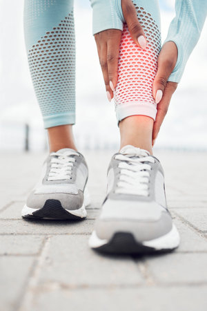 Fitness, injury and woman with shin pain during cardio exercise, training or outdoor workout....