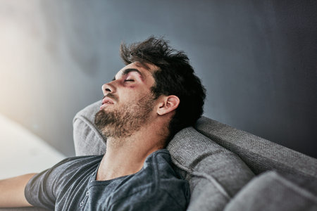 Beaten to a pulp. a beaten and bruised young man sleeping on the sofa.