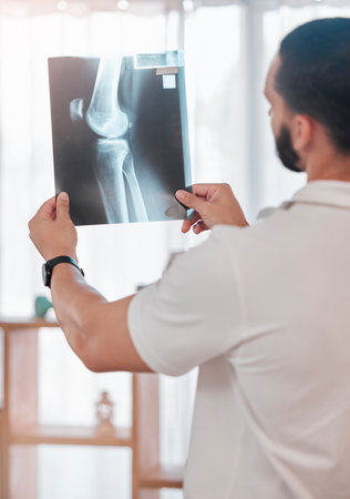 Man, physiotherapist and x ray scan analysis in sports clinic for broken bone check, healthcare...