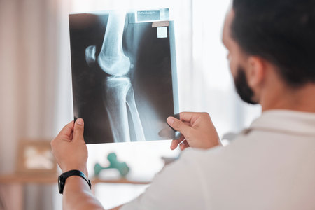 Health, x ray and physiotherapy, man physiotherapist check medical results from injury, broken bone...