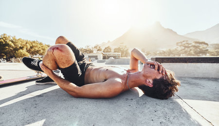 Fitness, knee injury and man in pain from blood wound after exercise, running or sports accident. Medical health emergency of an athlete hurt from workout and training on a building rooftopの写真素材