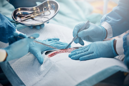 Doctors, nurses or surgery hands on cut patient in hospital emergency room for stomach ulcer, heart...