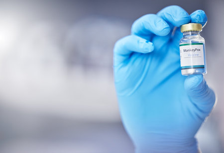 Innovation, healthcare or hand with vaccine, medicine or product in bottle with a blurry or blurred background. Monkey pox, doctor or scientist working on medical cure or lab drugs in safety glovesの写真素材