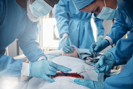Doctors, nurses or surgery hands on cut patient in hospital emergency room for stomach ulcer or...