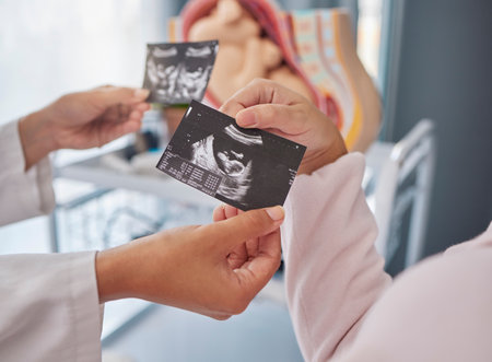 Doctor, hands and woman with ultrasound photo for fetus growth, development or family planning in clinic. Black woman medic, sonogram picture or healthcare for mother patient at hospital in pregnancyの写真素材