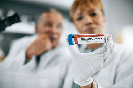 Doctor, monkeypox or scientist team in science laboratory on DNA research, medical or medicine data...